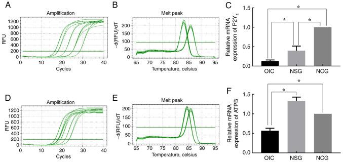 https://cdn.ncbi.nlm.nih.gov/pmc/blobs/5bc2/9798462/48c81c43e210/etm-25-01-11766-g04.jpg
