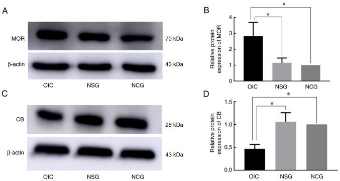 https://cdn.ncbi.nlm.nih.gov/pmc/blobs/5bc2/9798462/77b0db2e50b1/etm-25-01-11766-g07.jpg