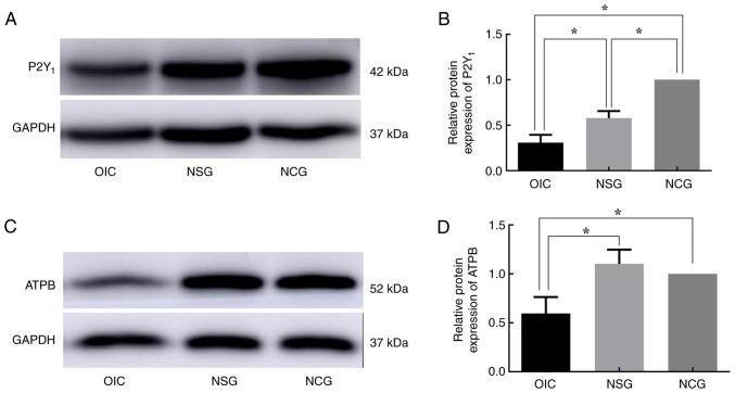 https://cdn.ncbi.nlm.nih.gov/pmc/blobs/5bc2/9798462/d9e32bb4f280/etm-25-01-11766-g06.jpg