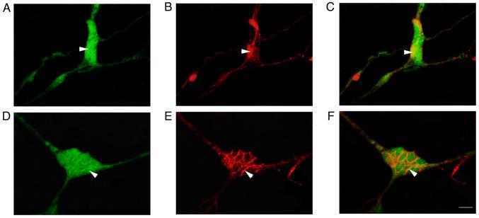 https://cdn.ncbi.nlm.nih.gov/pmc/blobs/5bc2/9798462/f7f88b73ba8d/etm-25-01-11766-g02.jpg