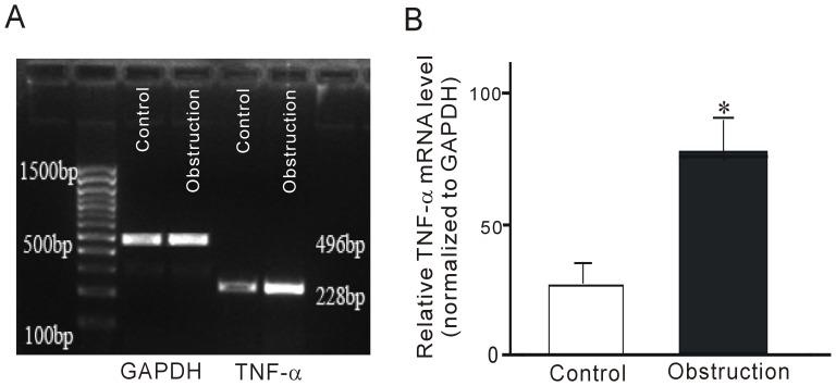 https://cdn.ncbi.nlm.nih.gov/pmc/blobs/5bc5/3486862/ffe4c264f92f/pone.0048249.g004.jpg