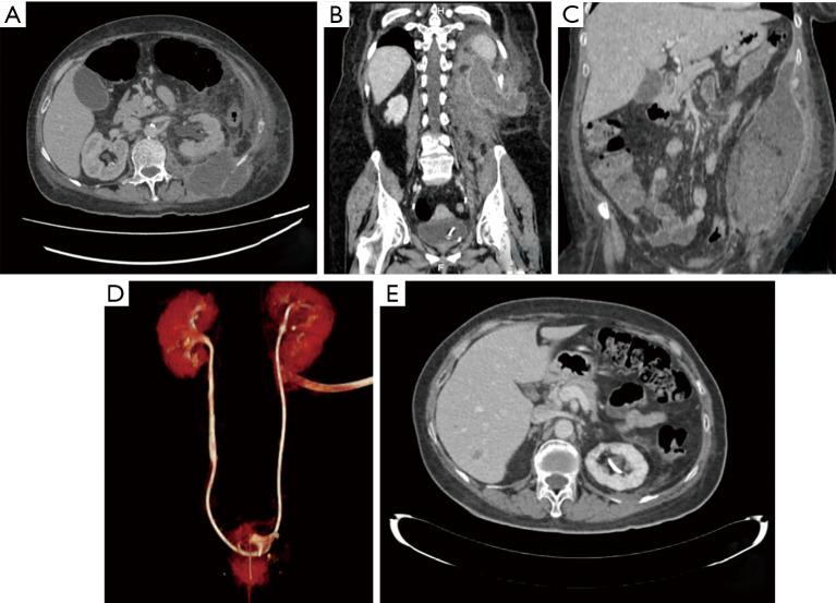 https://cdn.ncbi.nlm.nih.gov/pmc/blobs/5bce/7947471/3ef154675640/tau-10-02-963-f1.jpg