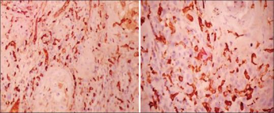 https://cdn.ncbi.nlm.nih.gov/pmc/blobs/5bd0/8083437/0be431dea989/JOMFP-24-577-g004.jpg