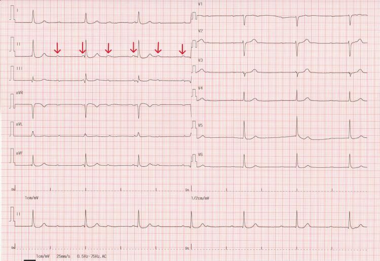 https://cdn.ncbi.nlm.nih.gov/pmc/blobs/5bd1/12431795/09d3bf1f588e/cureus-0017-00000090018-i03.jpg