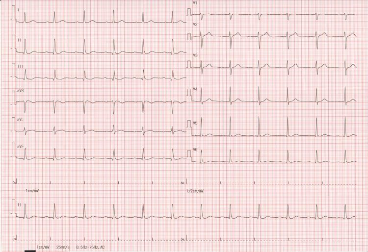 https://cdn.ncbi.nlm.nih.gov/pmc/blobs/5bd1/12431795/adb77f4890b3/cureus-0017-00000090018-i01.jpg