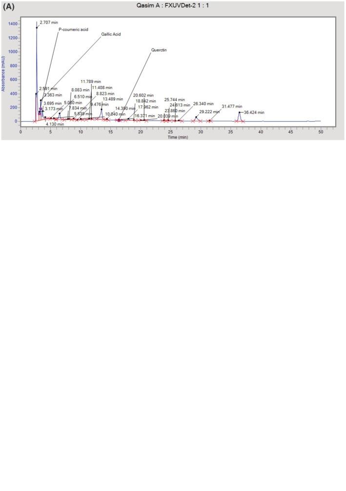 https://cdn.ncbi.nlm.nih.gov/pmc/blobs/5bd7/11914388/35249185ada2/FSN3-13-e70029-g002.jpg