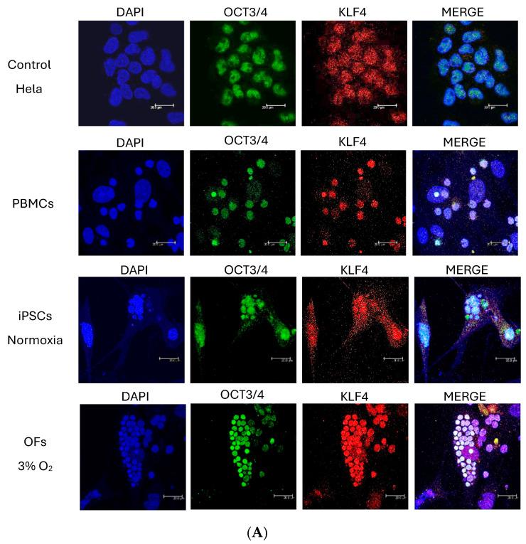 https://cdn.ncbi.nlm.nih.gov/pmc/blobs/5be1/11172288/cd0519cc98c5/cells-13-00971-g004a.jpg