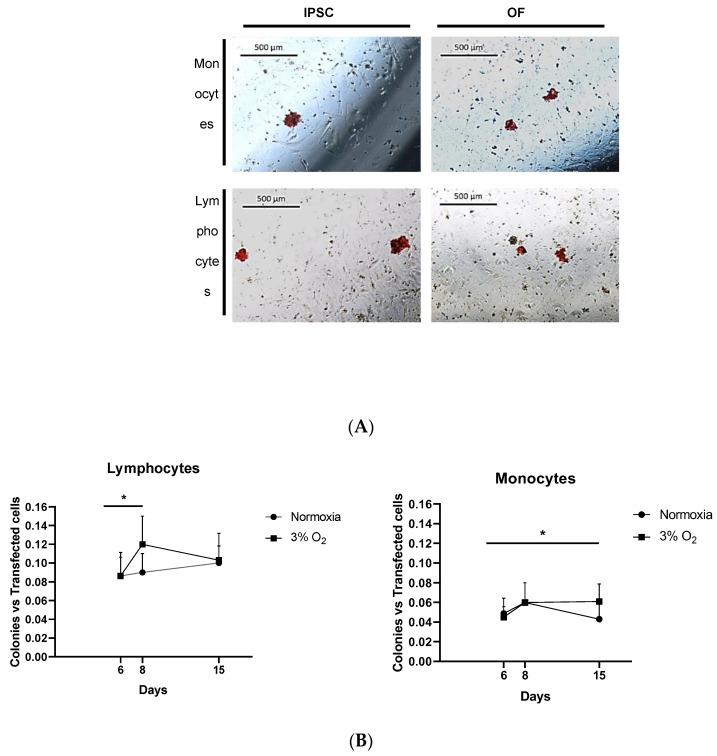 https://cdn.ncbi.nlm.nih.gov/pmc/blobs/5be1/11172288/dd8df19c90d4/cells-13-00971-g006.jpg