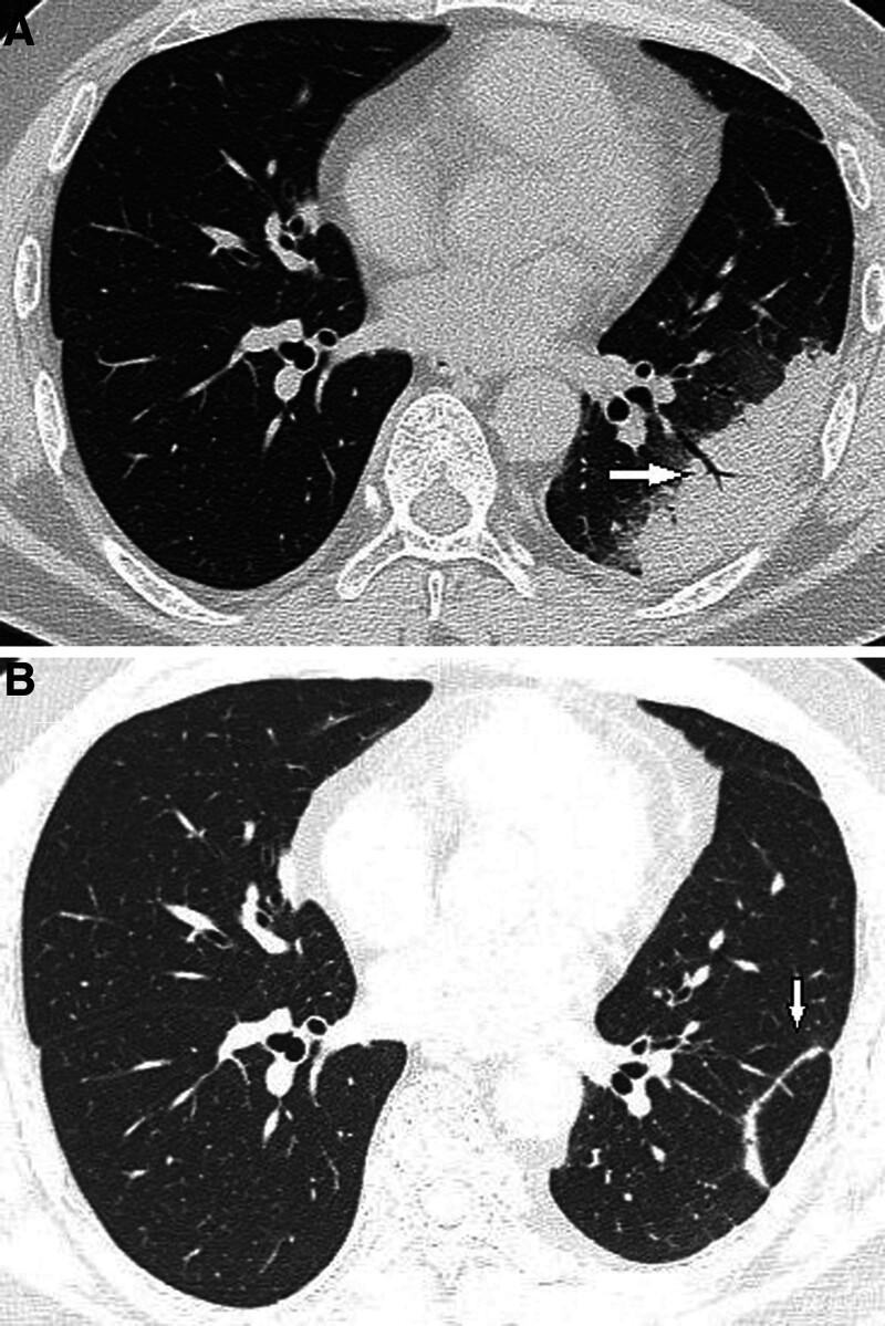 https://cdn.ncbi.nlm.nih.gov/pmc/blobs/5be2/11466118/561218c42c50/medi-103-e38671-g001.jpg