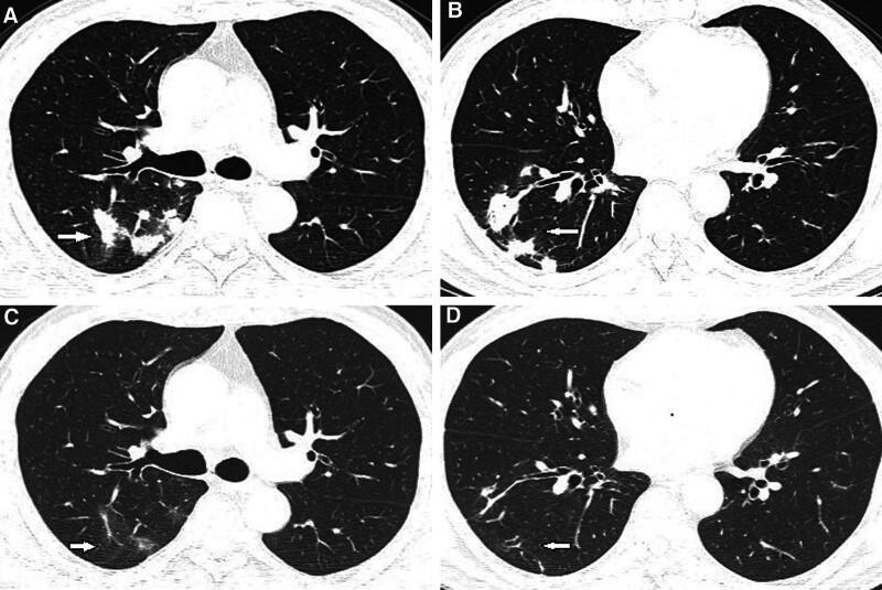 https://cdn.ncbi.nlm.nih.gov/pmc/blobs/5be2/11466118/fc6f331e4a20/medi-103-e38671-g003.jpg