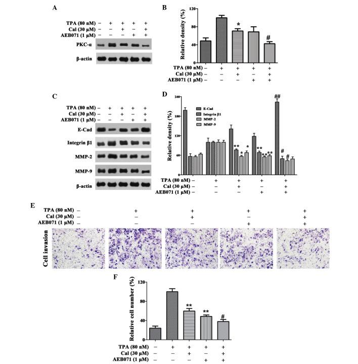 https://cdn.ncbi.nlm.nih.gov/pmc/blobs/5bf0/4758323/74ae1b972c7a/MMR-12-06-7992-g03.jpg