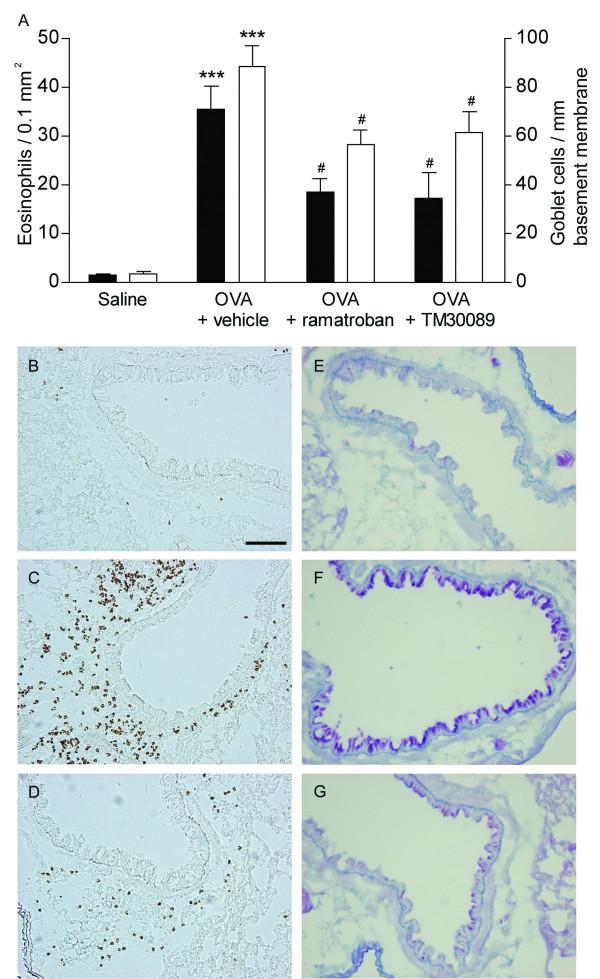 https://cdn.ncbi.nlm.nih.gov/pmc/blobs/5bf7/1810525/414c267fdf58/1465-9921-8-16-2.jpg