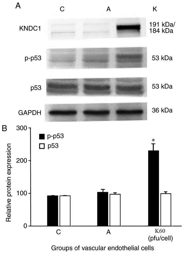https://cdn.ncbi.nlm.nih.gov/pmc/blobs/5bf7/5928657/ba6e8620c529/MMR-17-05-7037-g03.jpg