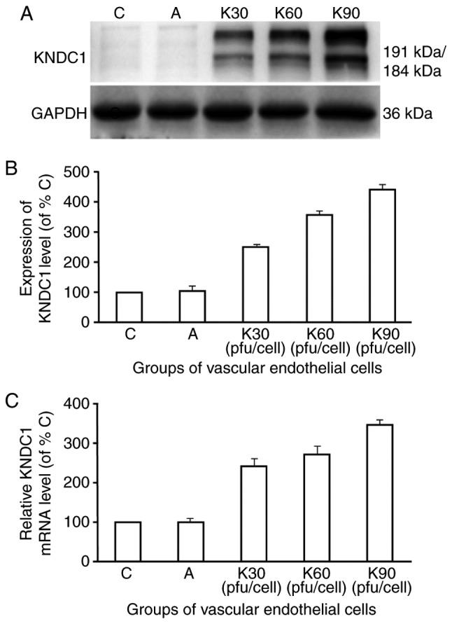 https://cdn.ncbi.nlm.nih.gov/pmc/blobs/5bf7/5928657/c9fbaca6705d/MMR-17-05-7037-g01.jpg