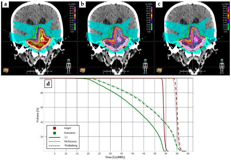 https://cdn.ncbi.nlm.nih.gov/pmc/blobs/5c01/11171191/4c260c08075a/cancers-16-02085-g001.jpg