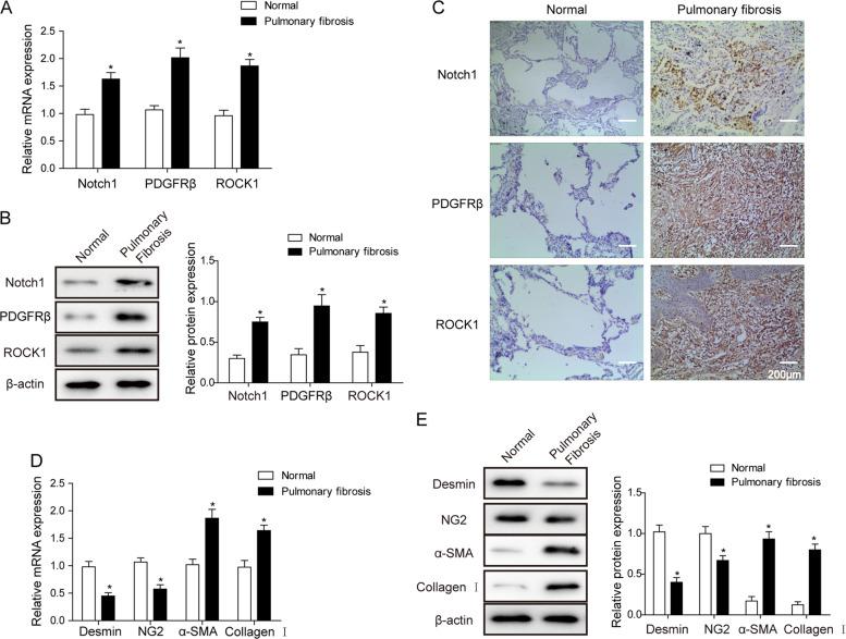 https://cdn.ncbi.nlm.nih.gov/pmc/blobs/5c03/6430797/b2f9dbb4dd01/12276_2019_228_Fig1_HTML.jpg