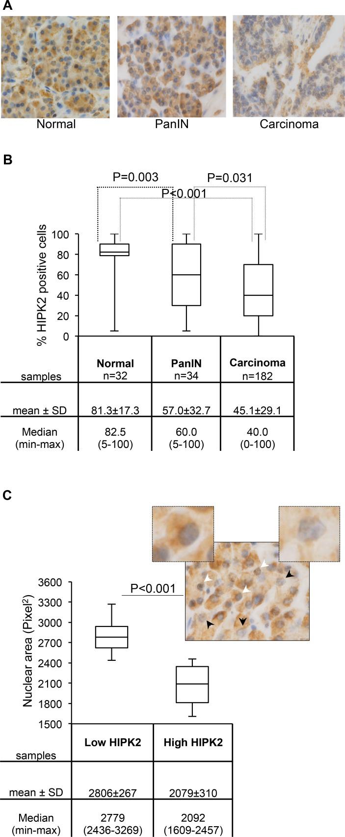 https://cdn.ncbi.nlm.nih.gov/pmc/blobs/5c06/4496358/668a1eae1749/oncotarget-06-10320-g005.jpg