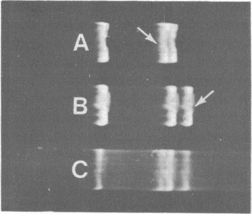 https://cdn.ncbi.nlm.nih.gov/pmc/blobs/5c11/324309/f1bdd8d1ed65/nar00439-0257-a.jpg