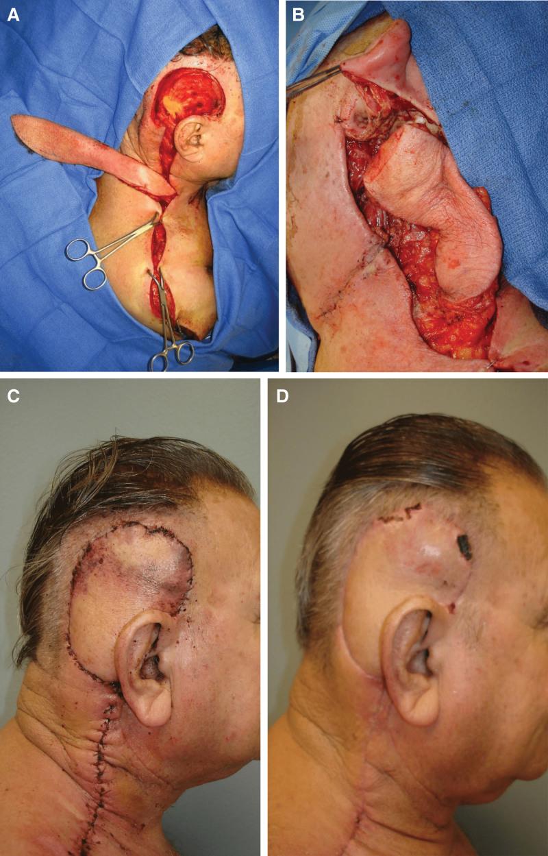 https://cdn.ncbi.nlm.nih.gov/pmc/blobs/5c22/10278690/66828eca62ff/gox-11-e5052-g005.jpg