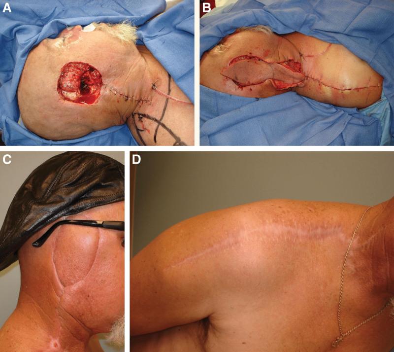 https://cdn.ncbi.nlm.nih.gov/pmc/blobs/5c22/10278690/d6bf5706401c/gox-11-e5052-g002.jpg