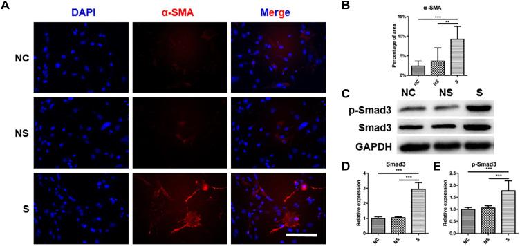 https://cdn.ncbi.nlm.nih.gov/pmc/blobs/5c28/8001608/0dadfdd76e46/JIR-14-1055-g0006.jpg
