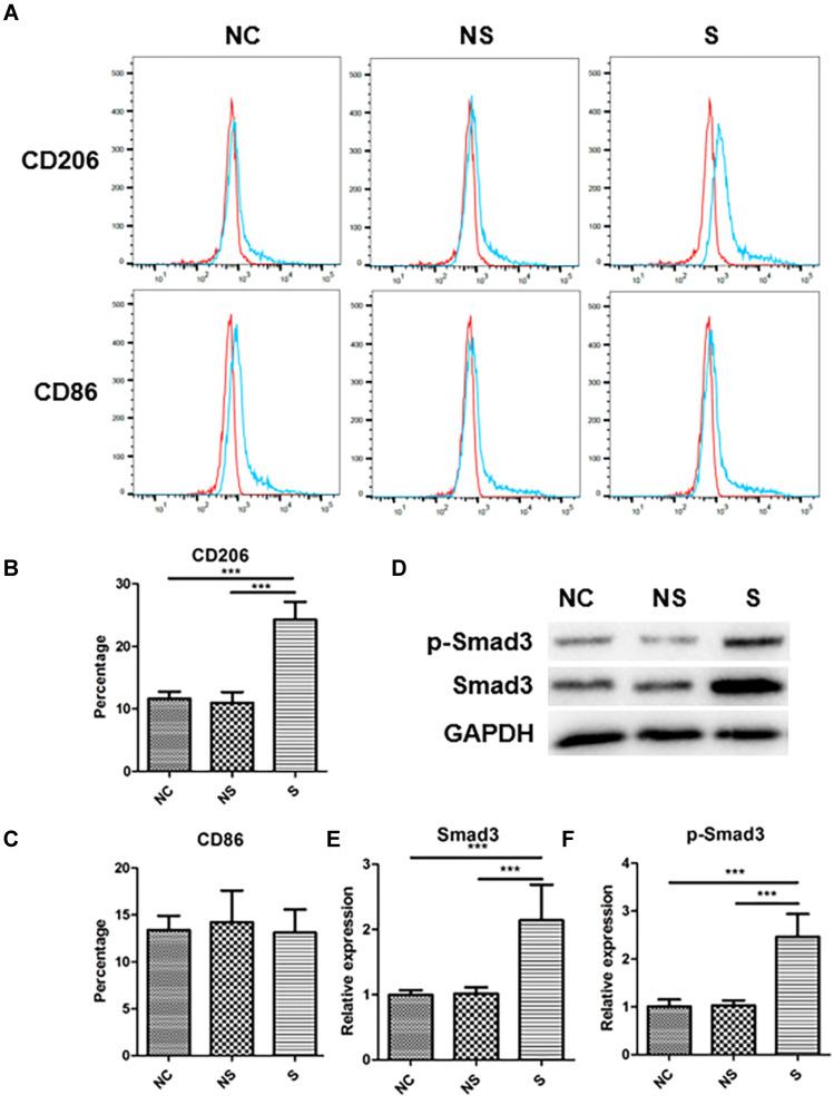 https://cdn.ncbi.nlm.nih.gov/pmc/blobs/5c28/8001608/2e265828dd19/JIR-14-1055-g0004.jpg