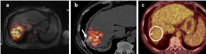 https://cdn.ncbi.nlm.nih.gov/pmc/blobs/5c29/11265365/0a0280fb5c92/gr5.jpg