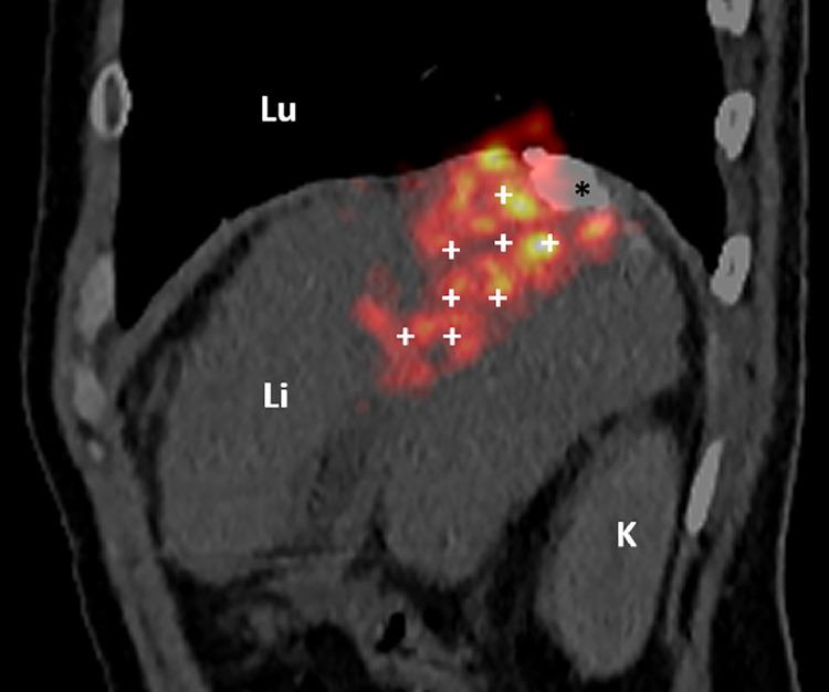 https://cdn.ncbi.nlm.nih.gov/pmc/blobs/5c29/11265365/59e5978e7864/gr2.jpg