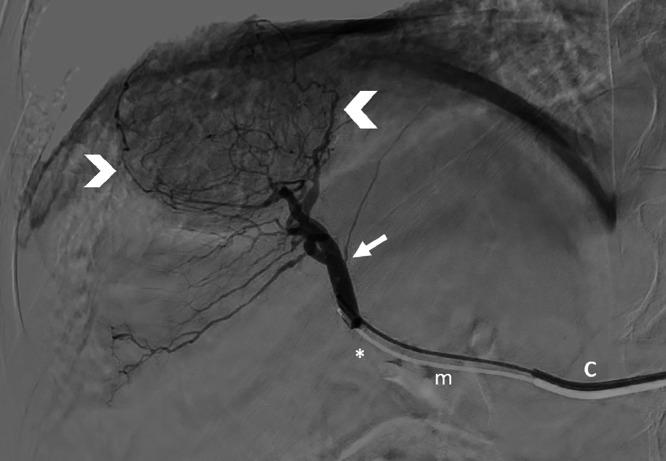 https://cdn.ncbi.nlm.nih.gov/pmc/blobs/5c29/11265365/b51697871322/gr1.jpg