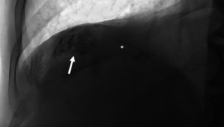 https://cdn.ncbi.nlm.nih.gov/pmc/blobs/5c29/11265365/c6065be507ec/gr3.jpg