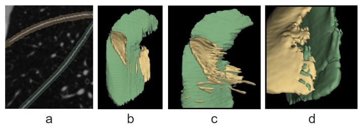 https://cdn.ncbi.nlm.nih.gov/pmc/blobs/5c2a/11510873/850e09a96c7e/tomography-10-00121-g004.jpg
