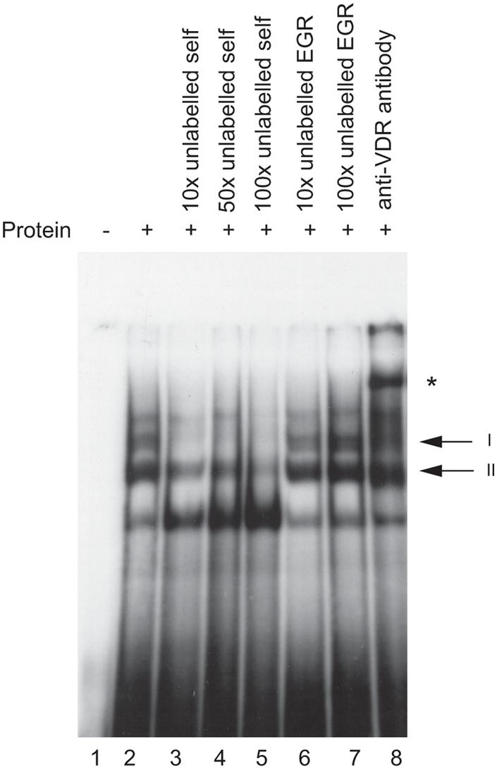 https://cdn.ncbi.nlm.nih.gov/pmc/blobs/5c2c/2627899/9e28b414ef18/pgen.1000369.g002.jpg