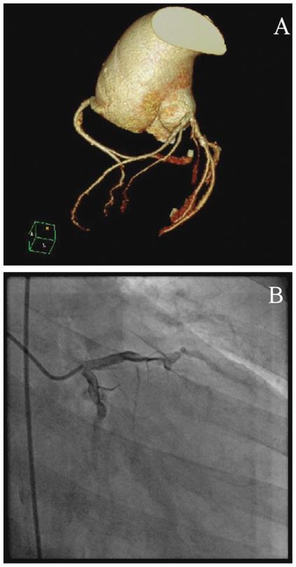 https://cdn.ncbi.nlm.nih.gov/pmc/blobs/5c2c/2882544/7a083d24377b/cln_65p497f3.jpg