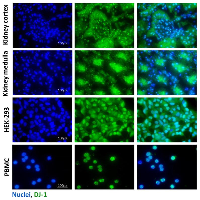 https://cdn.ncbi.nlm.nih.gov/pmc/blobs/5c2d/12189621/8a6cbb48cbb9/antioxidants-14-00719-g001.jpg
