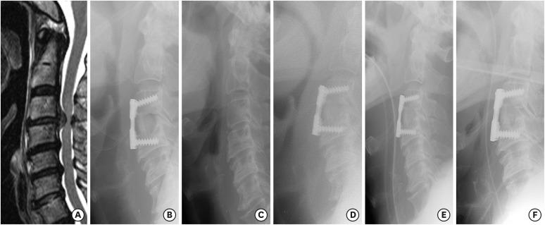https://cdn.ncbi.nlm.nih.gov/pmc/blobs/5c2d/5909108/72d92b0a7d57/jkms-33-e77-g001.jpg