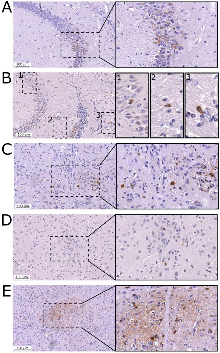 https://cdn.ncbi.nlm.nih.gov/pmc/blobs/5c39/10458464/d30f26374470/viruses-15-01674-g009.jpg