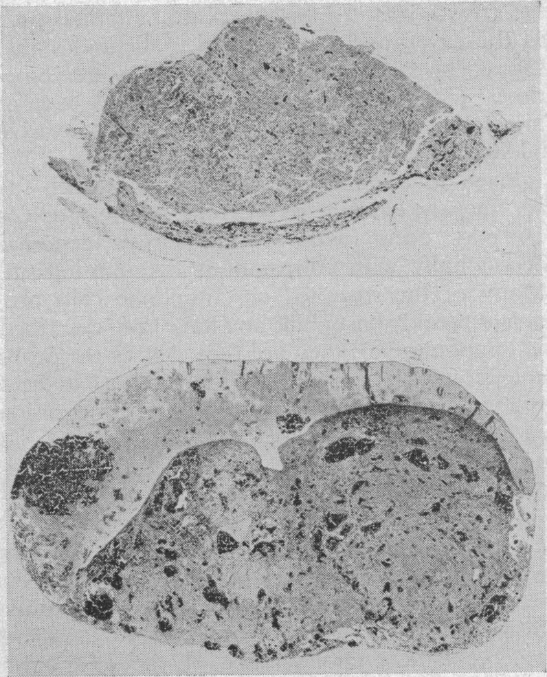 https://cdn.ncbi.nlm.nih.gov/pmc/blobs/5c3b/1870457/9c3815a67f18/procrsmed00243-0146-b.jpg