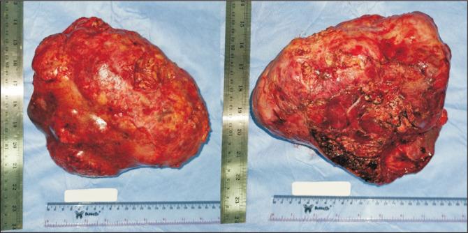 https://cdn.ncbi.nlm.nih.gov/pmc/blobs/5c3e/11830890/525e62a03262/ahbps-29-1-11-f1.jpg