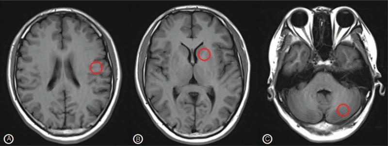 https://cdn.ncbi.nlm.nih.gov/pmc/blobs/5c3e/6203517/f06a43a89aff/medi-97-e12768-g002.jpg