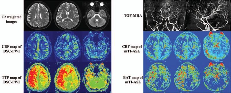 https://cdn.ncbi.nlm.nih.gov/pmc/blobs/5c3e/6203517/f0fd5a137256/medi-97-e12768-g005.jpg