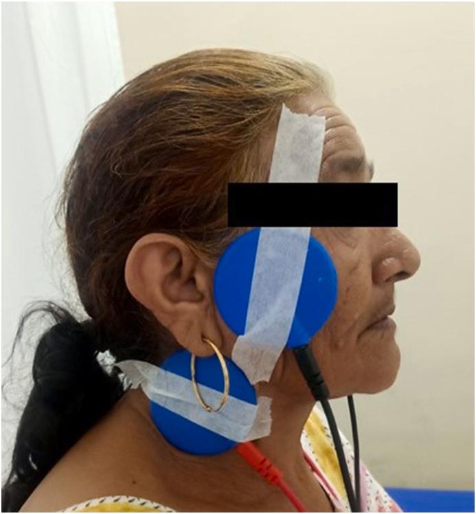 https://cdn.ncbi.nlm.nih.gov/pmc/blobs/5c44/11732451/bf9b00dcd113/gr1a.jpg