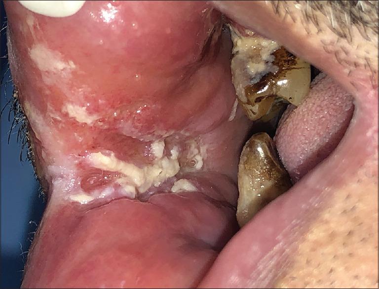https://cdn.ncbi.nlm.nih.gov/pmc/blobs/5c49/9802504/244db5821541/JOMFP-26-399-g001.jpg