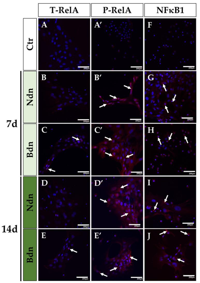 https://cdn.ncbi.nlm.nih.gov/pmc/blobs/5c4a/10932267/3e58d8063a28/ijms-25-02833-g003.jpg