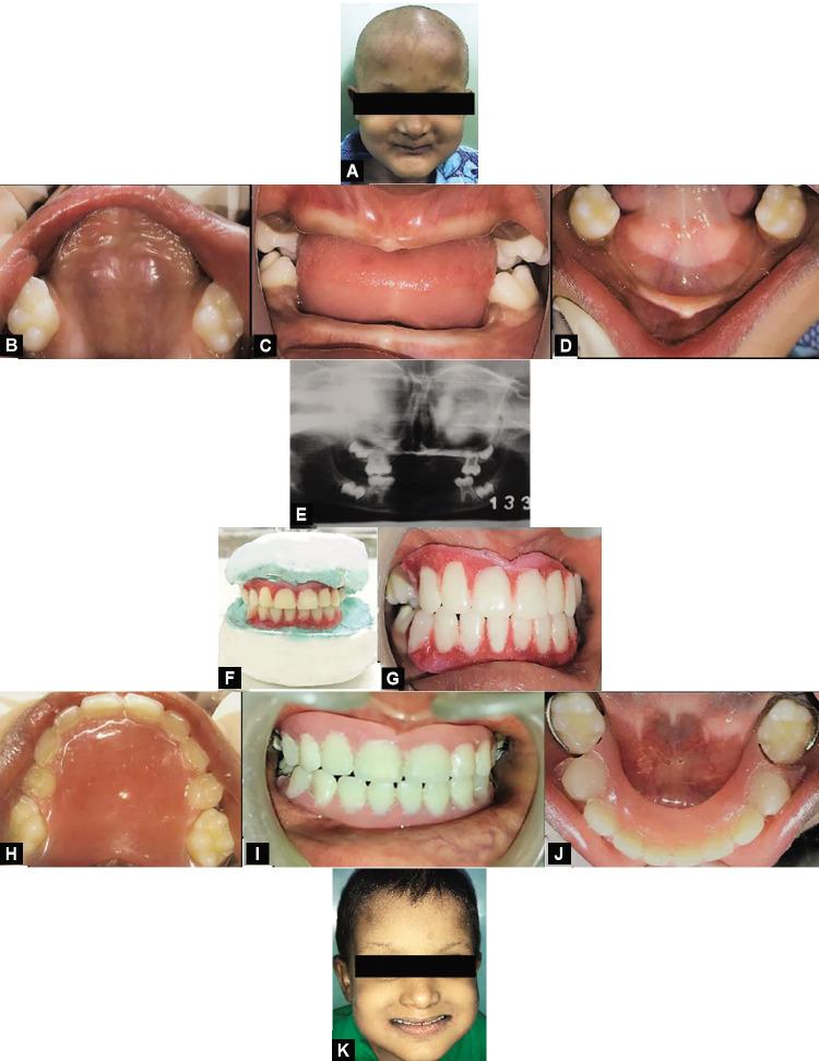 https://cdn.ncbi.nlm.nih.gov/pmc/blobs/5c4b/10367292/22af8f6384bf/ijcpd-16-534-g001.jpg