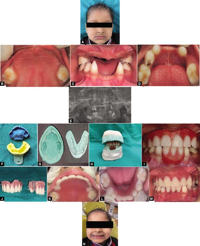 https://cdn.ncbi.nlm.nih.gov/pmc/blobs/5c4b/10367292/da9bf881862b/ijcpd-16-534-g002.jpg