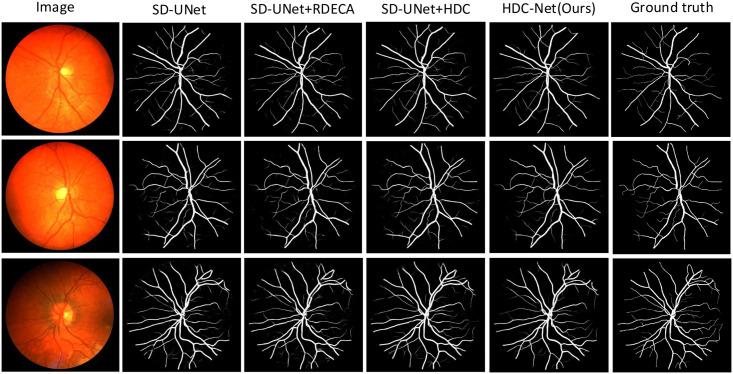 https://cdn.ncbi.nlm.nih.gov/pmc/blobs/5c4c/8423235/fc9168c88176/pone.0257013.g013.jpg