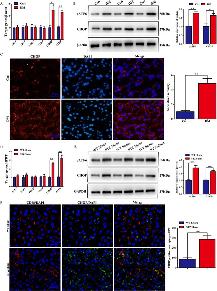 https://cdn.ncbi.nlm.nih.gov/pmc/blobs/5c4f/8921205/abaa269918b5/41420_2022_910_Fig1_HTML.jpg