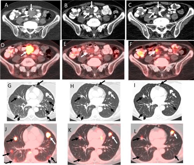 https://cdn.ncbi.nlm.nih.gov/pmc/blobs/5c52/8636467/7ea7b0825ac7/41698_2021_240_Fig2_HTML.jpg