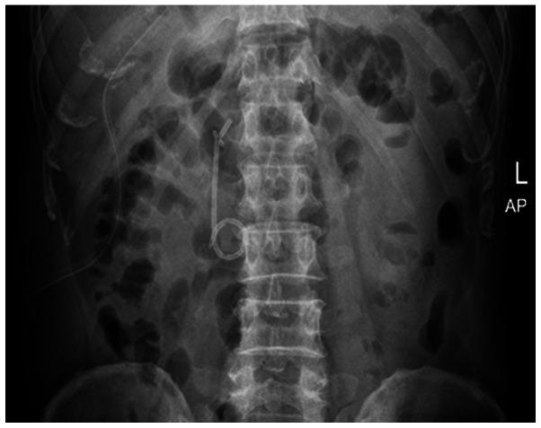 https://cdn.ncbi.nlm.nih.gov/pmc/blobs/5c57/9829082/f6d3ff90db39/mi-01-04-00014-g05.jpg