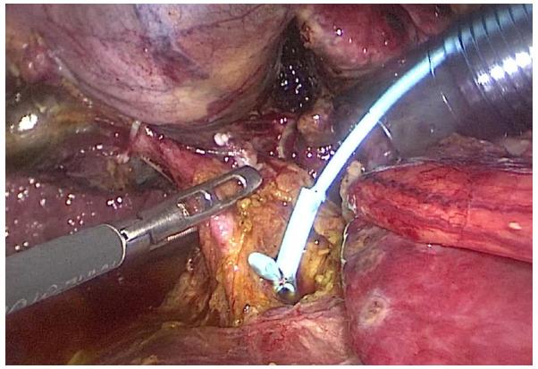 https://cdn.ncbi.nlm.nih.gov/pmc/blobs/5c57/9829082/ffa8a62eaacc/mi-01-04-00014-g04.jpg